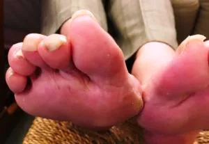 Embarassing, uncared for feet